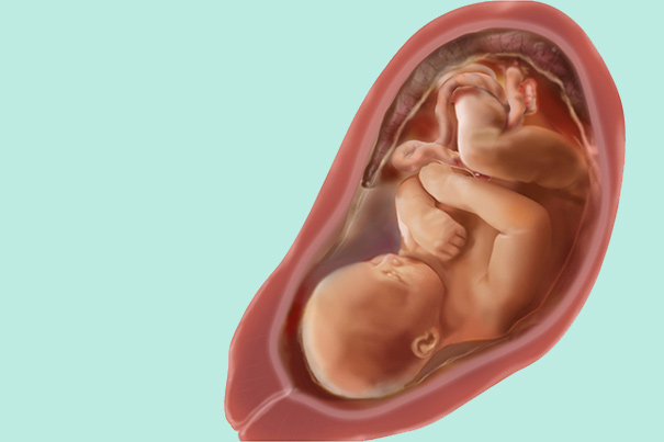 Como Se Ve Un Bebe De 33 Semanas De Gestacion 